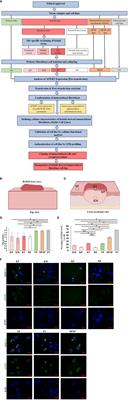 Development and validation of novel keloid-derived immortalized fibroblast cell lines